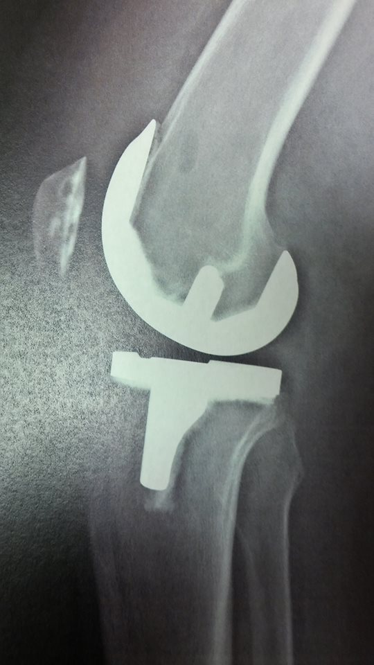 14721698_1721834671476975_1070972089214771431_n